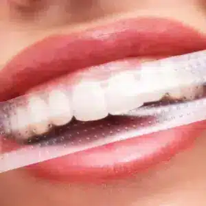 Bandes de Blanchiment dentaire